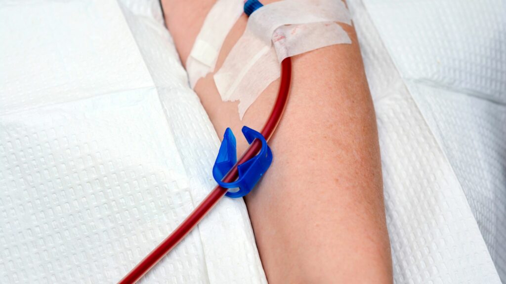 Ozone Blood Therapy